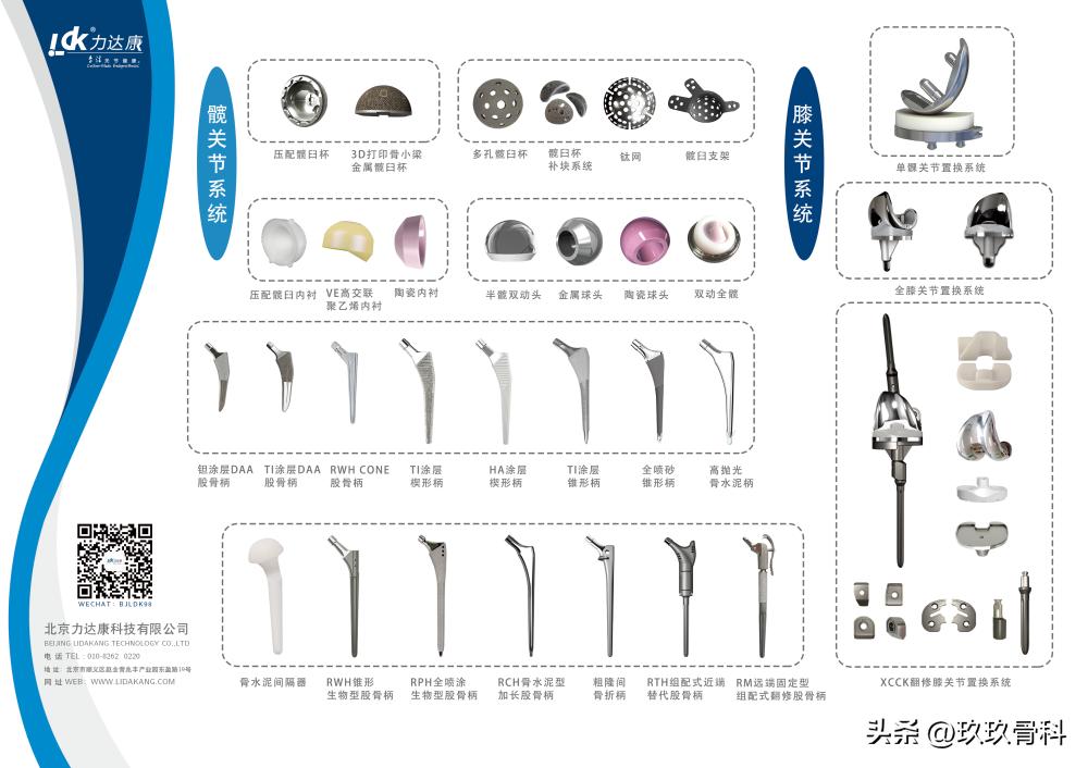 力达康定制型模块化假体治疗“肿瘤切除术后半骨盆缺损”