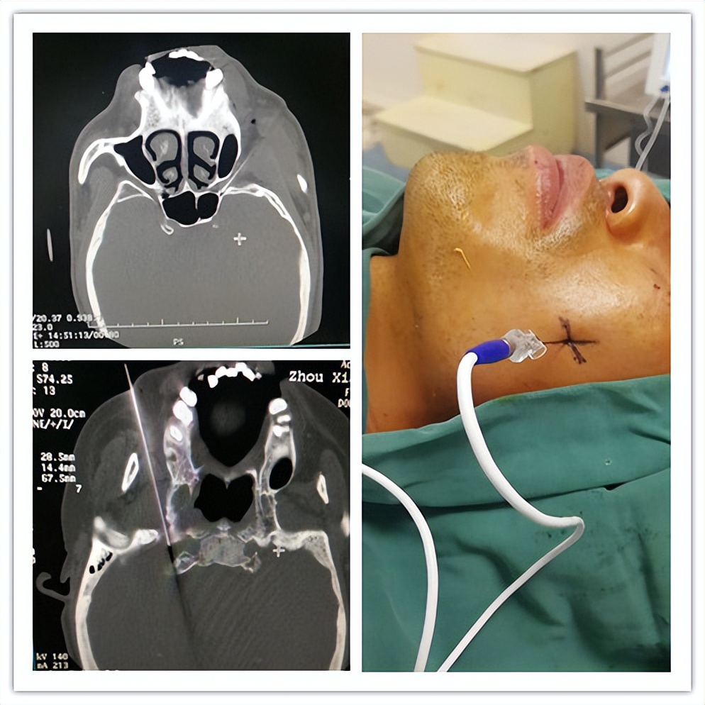 嘉善人民医院疼痛科专家,嘉善第一人民医院中医内科