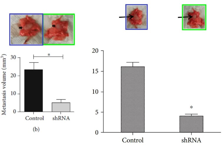 极大关注！天津医科大学第二医院发表的论文因明显图片重复被质疑