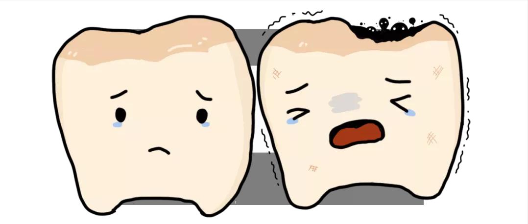 龋齿很小医生说不用补,龋齿不疼去补要做根管治疗吗