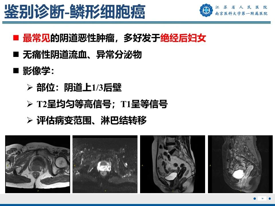 好文分享——《胚胎型横纹肌肉瘤》