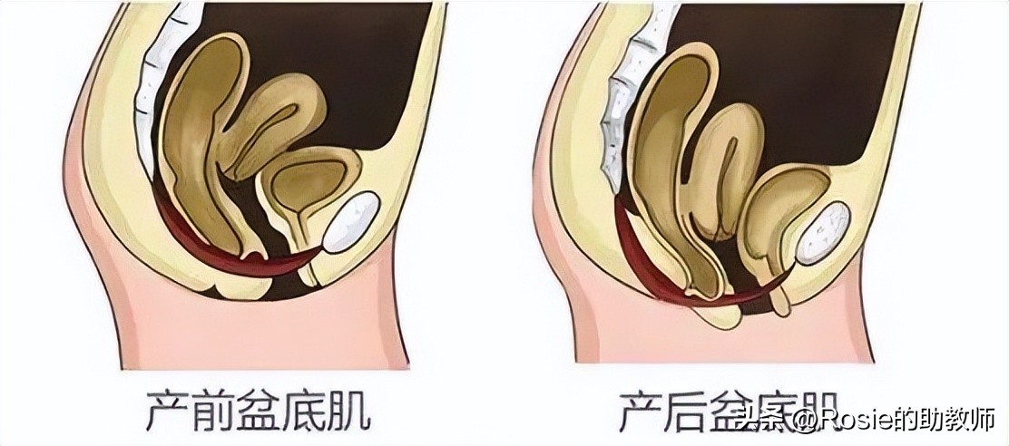 张歆艺盆底肌,张歆艺自曝产后瘦身秘诀