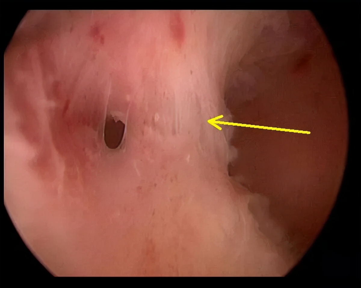 好医生被害案例,好医生结局解析