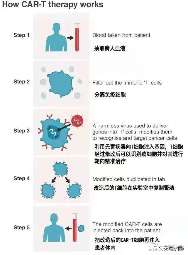 car-t细胞疗法会复发吗,car-t疗法真的能让癌细胞一针清零