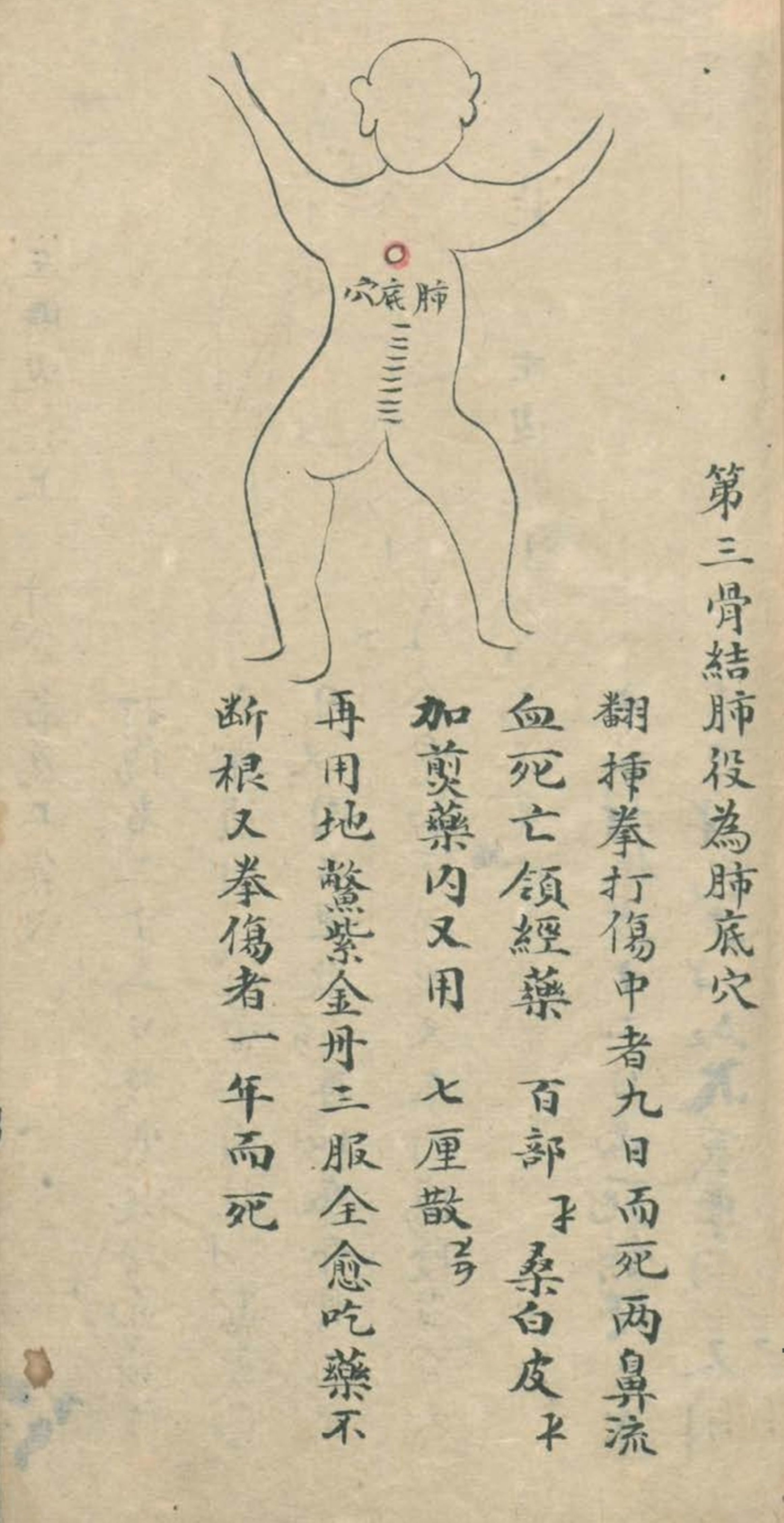 武当秘传跌打八法,民间中医古籍手抄本专医跌打秘方