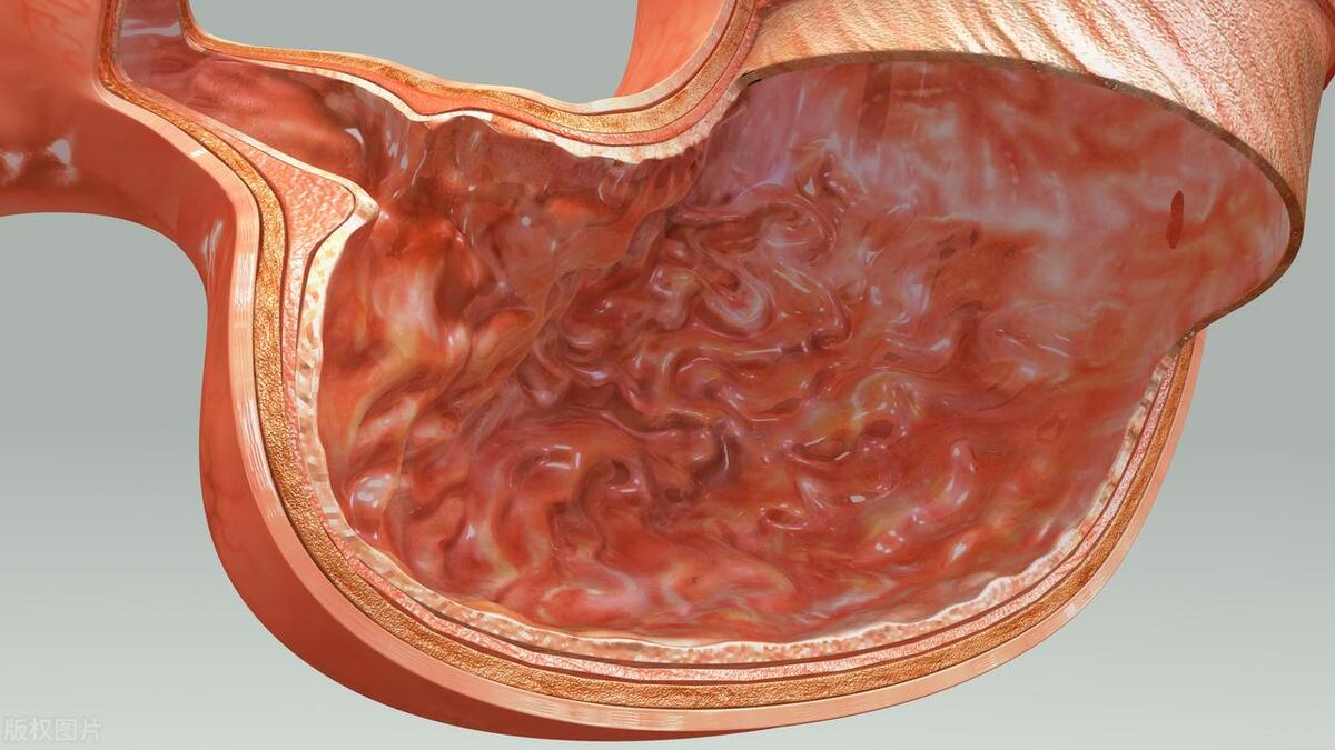 胃酸过多冷知识,关于胃酸的冷知识