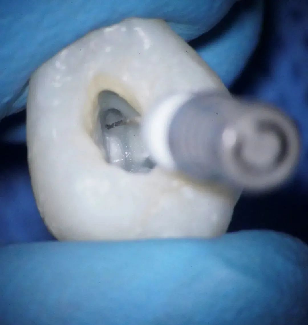 抽神经是什么感觉,抽神经的时候有没有后悔过