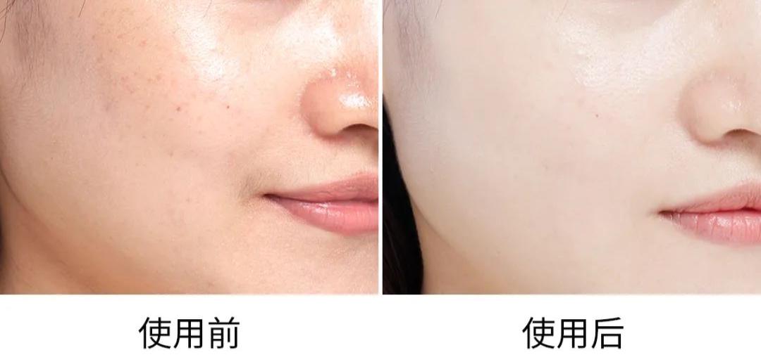 正品新款资生堂悦薇水乳中样套盒,资生堂悦薇水乳2020年双十一