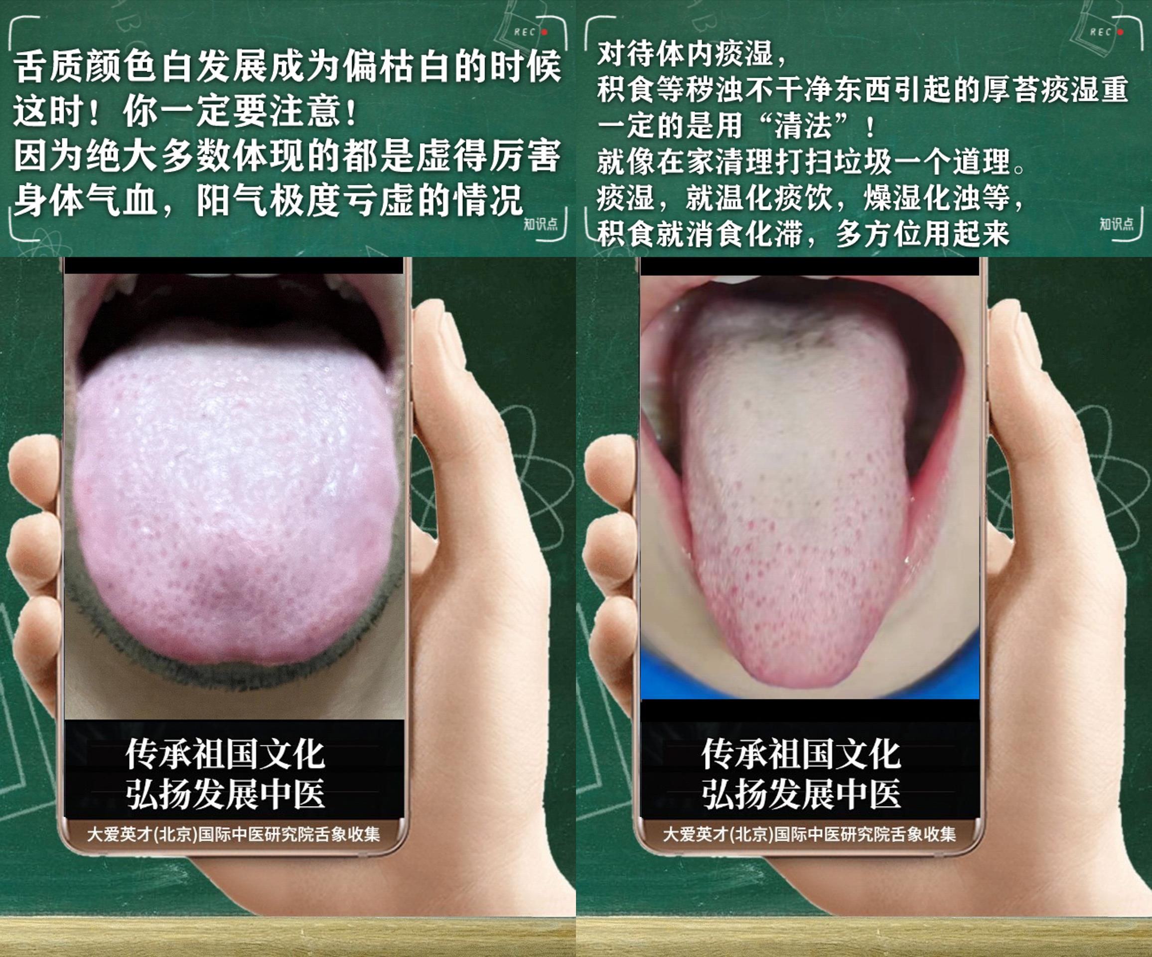 嗜睡肢冷鼻塞中医辨证,中医讲解感冒手脚冰凉