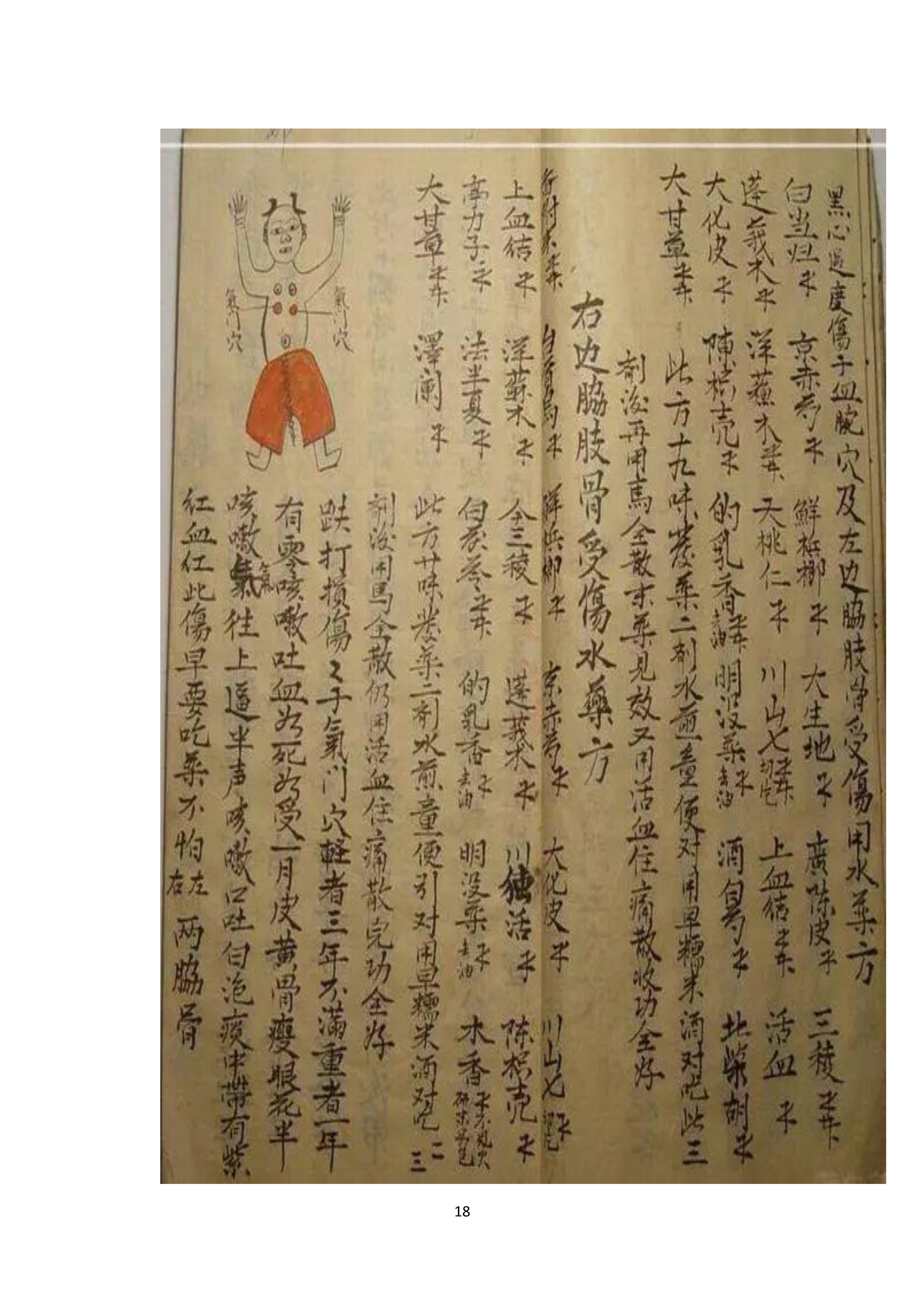 中医古书籍清代带图且内容非常好的手抄跌打损伤良方