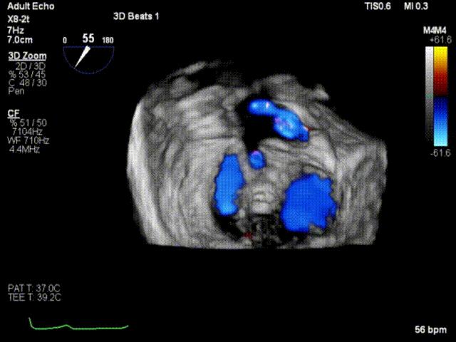 杨剑教授中国科学院,西京医院心血管外科杨剑