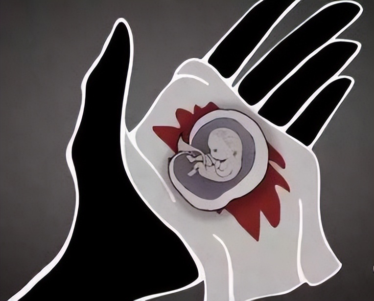 人流流出的胎儿扔了吗,医院做人流的胎儿怎么处理