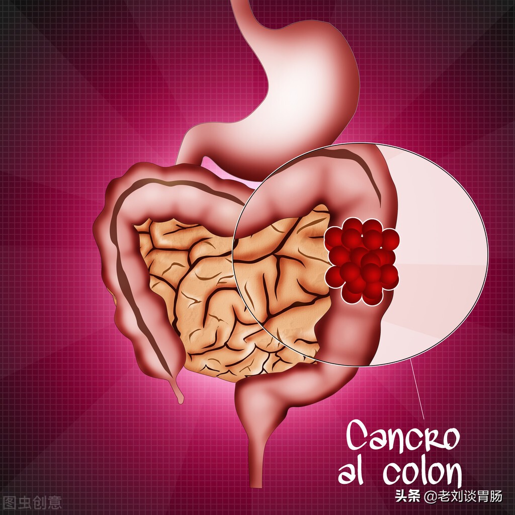 排便习惯改变一定是肠癌么,排便习惯改变是什么问题