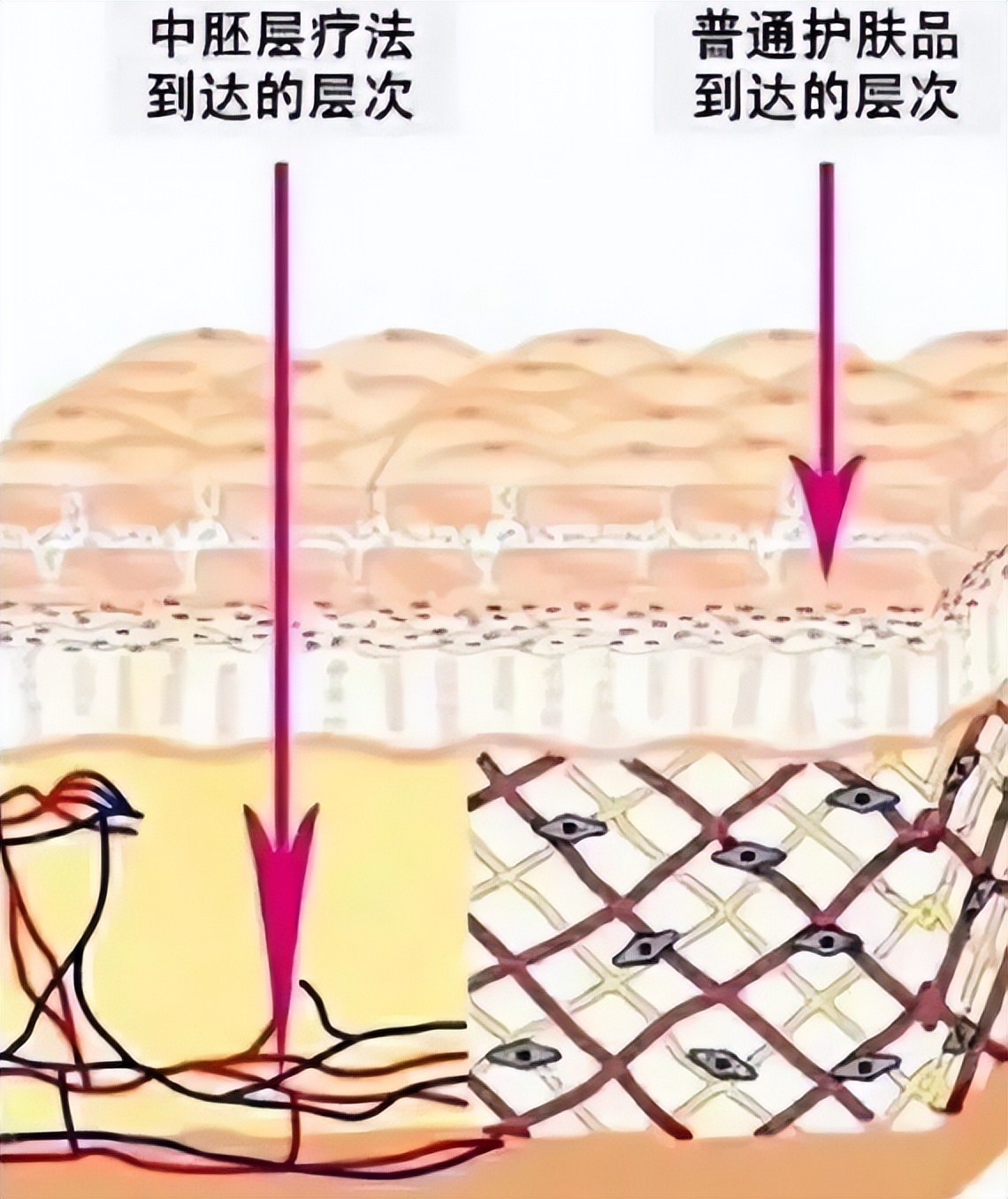 我终于鼓起勇气,打水光针有多痛苦