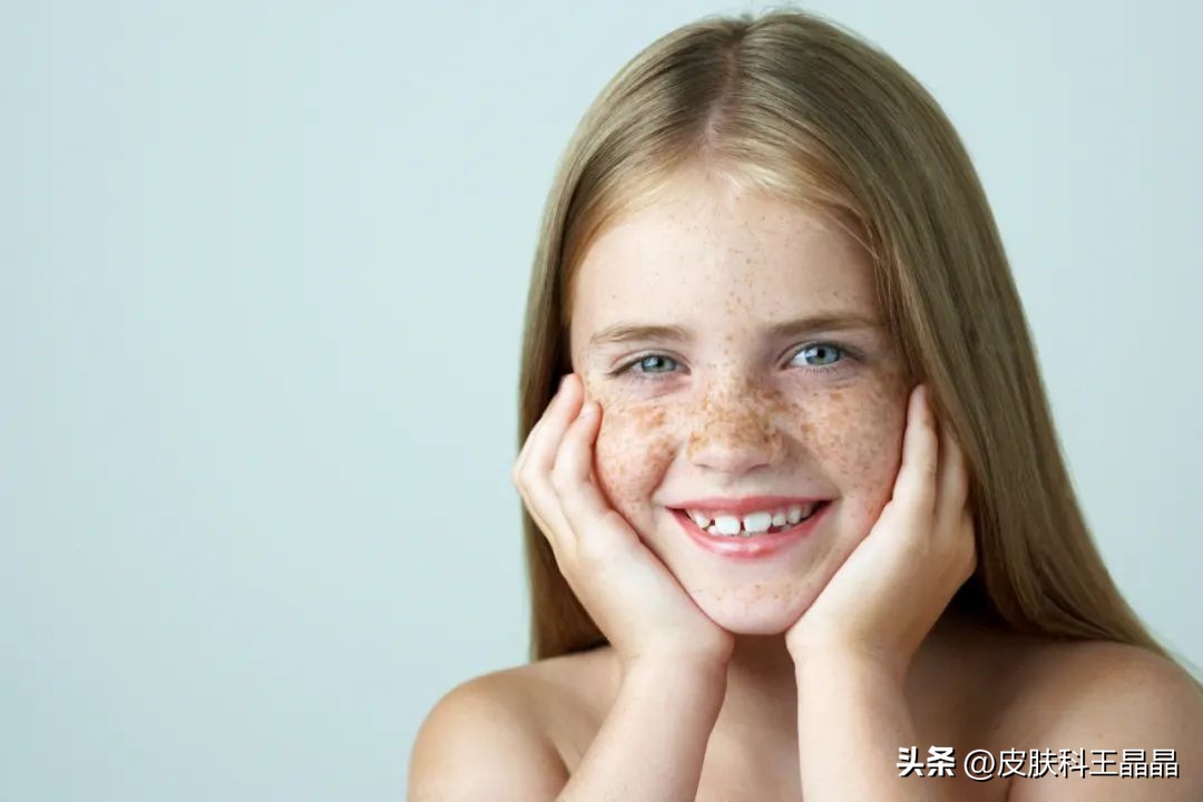色斑用任何方法都祛不掉怎么办,色斑应该治吗