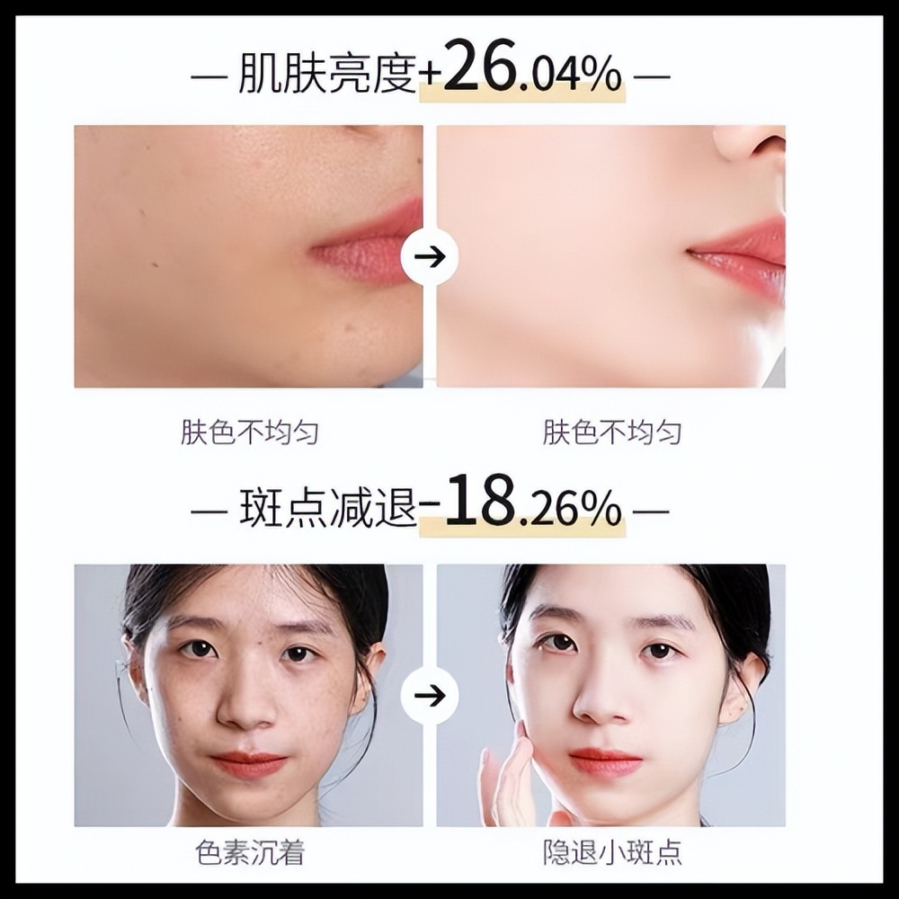 拼多多美白淡斑护肤品排行榜,美白淡斑护肤品国货排行榜前十名