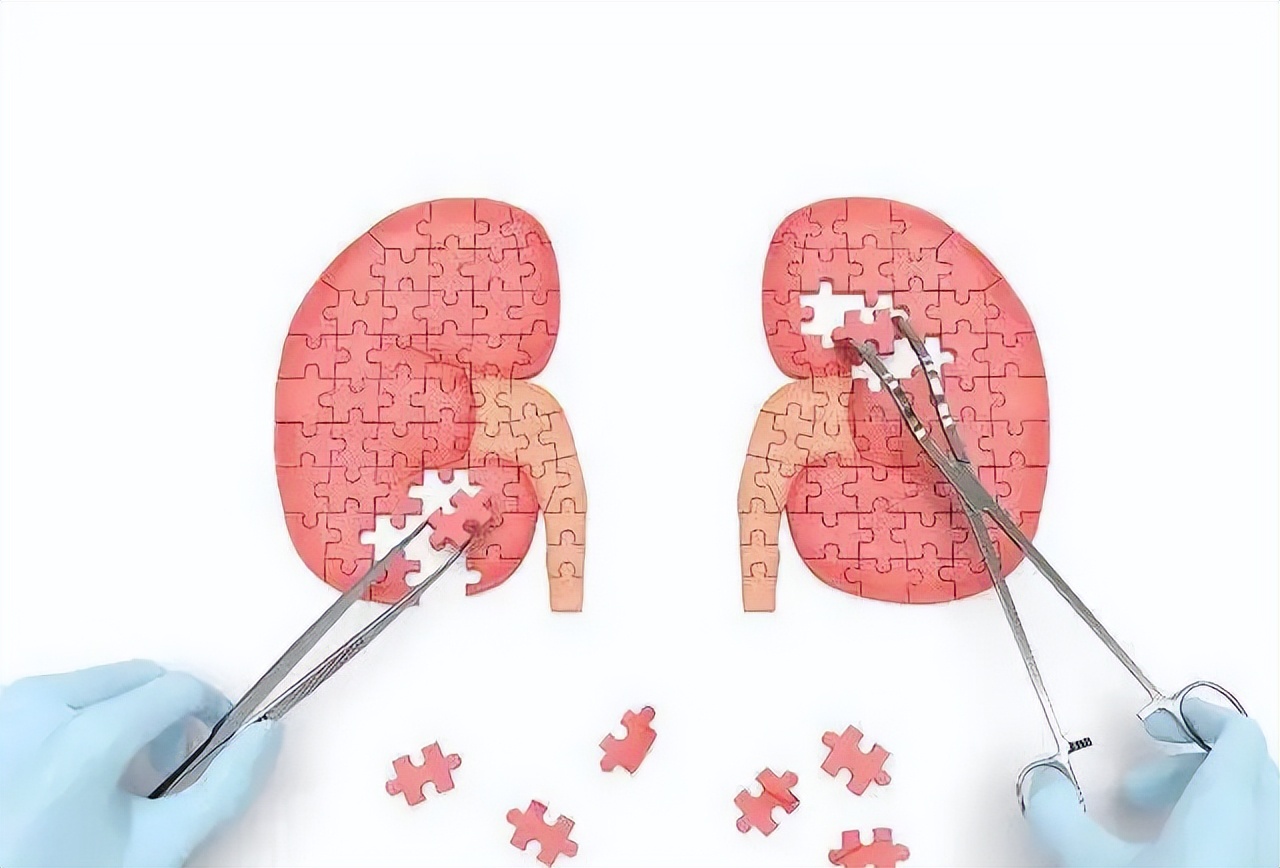 肾小球肾炎能治愈吗,肾小球肾炎还能自愈吗