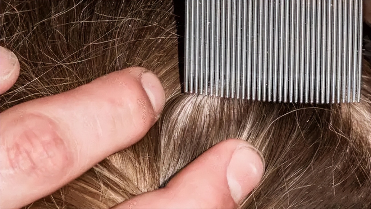 曾经的虱子怎么会灭绝了,为什么现在还有虱子存在