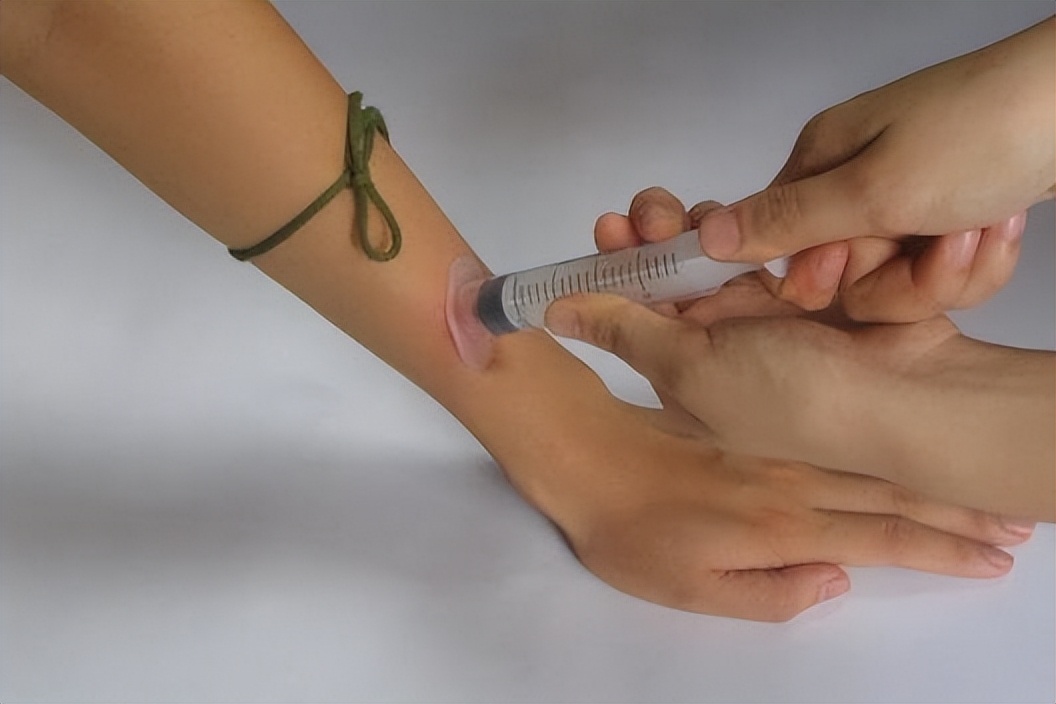 野外毒蛇咬伤急救方法,在农村路上碰到蛇怎么办