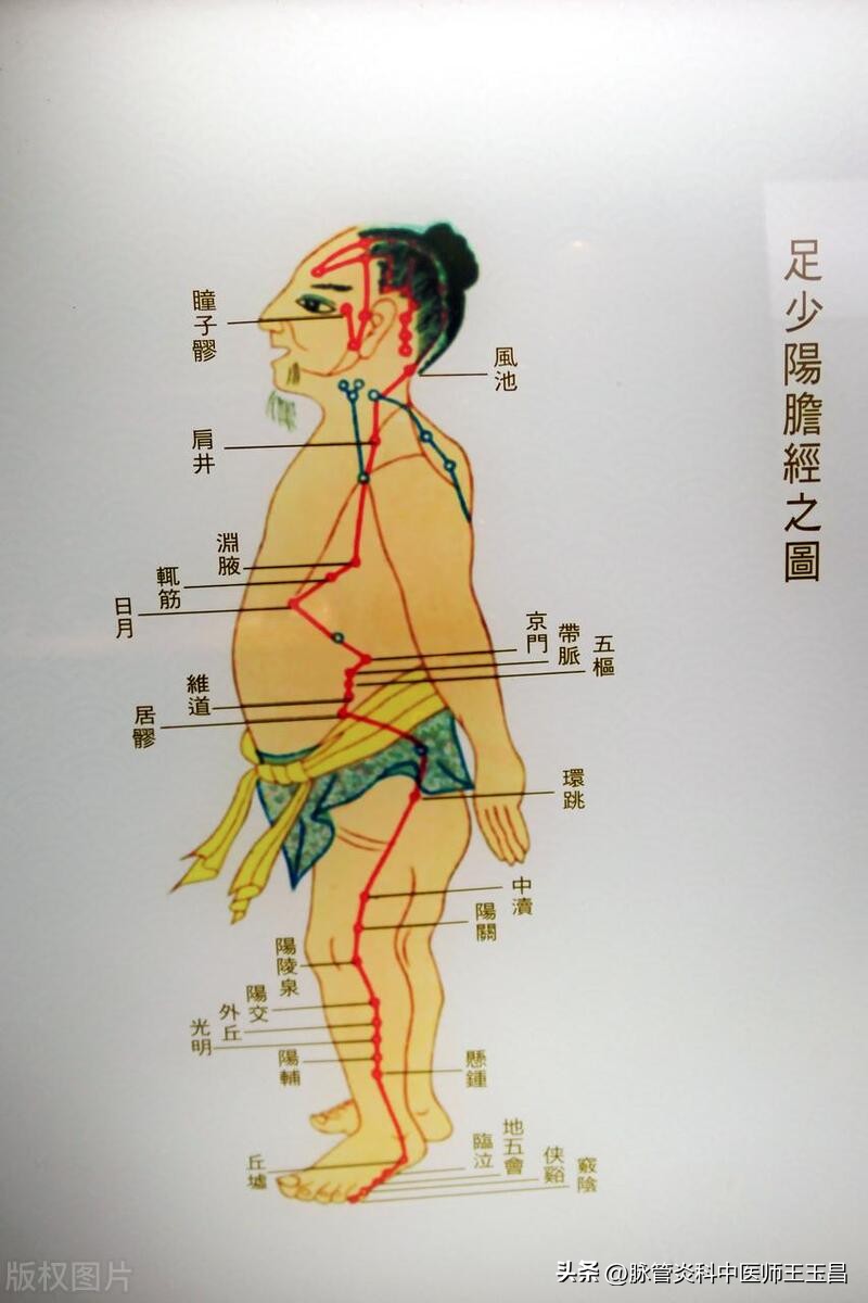 下肢静脉曲张的中医辨证,无锡易可中医治下肢静脉曲张