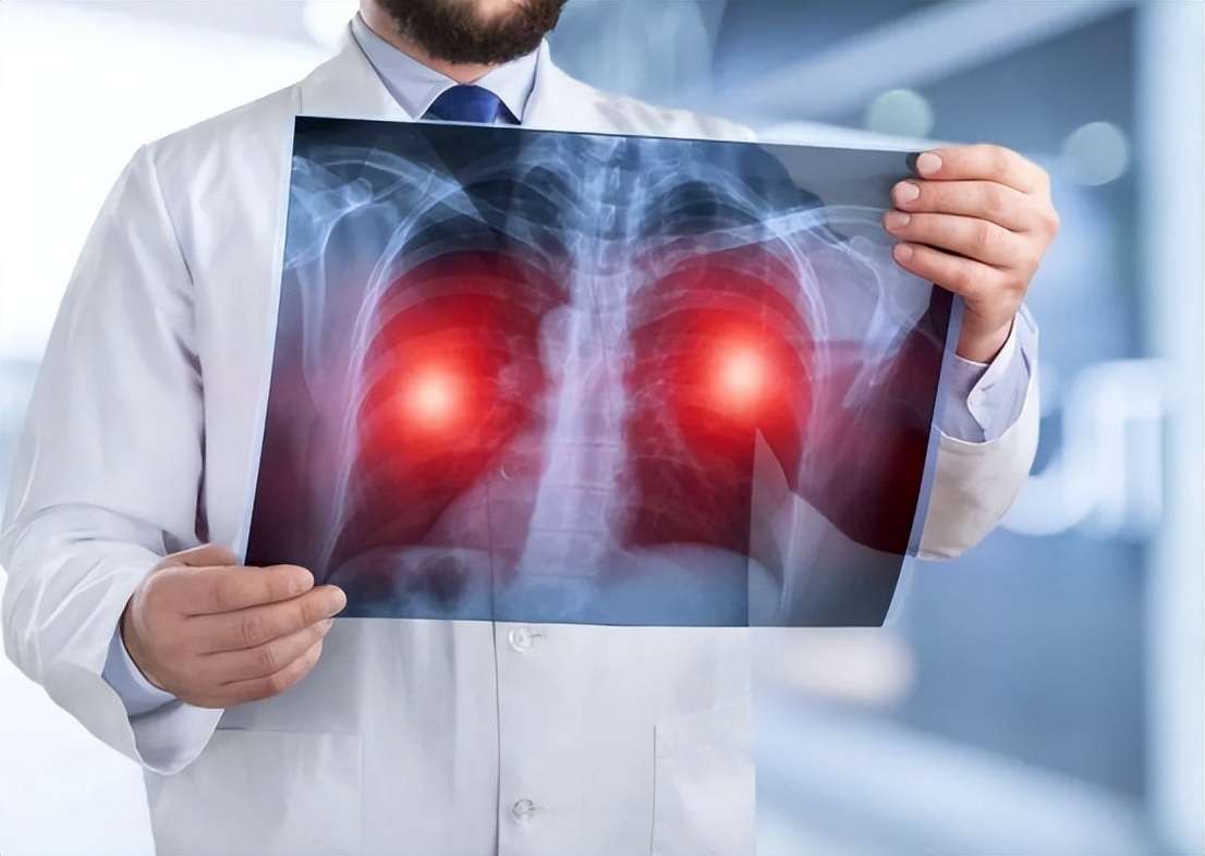 国产球囊治疗小儿肺动脉瓣狭窄可行吗？安全性如何？