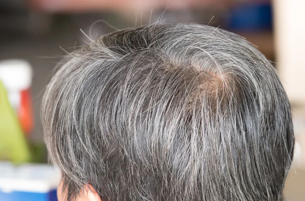 阴毛有何作用?要刮掉吗?从黑变白表示着什么?不要羞于了解