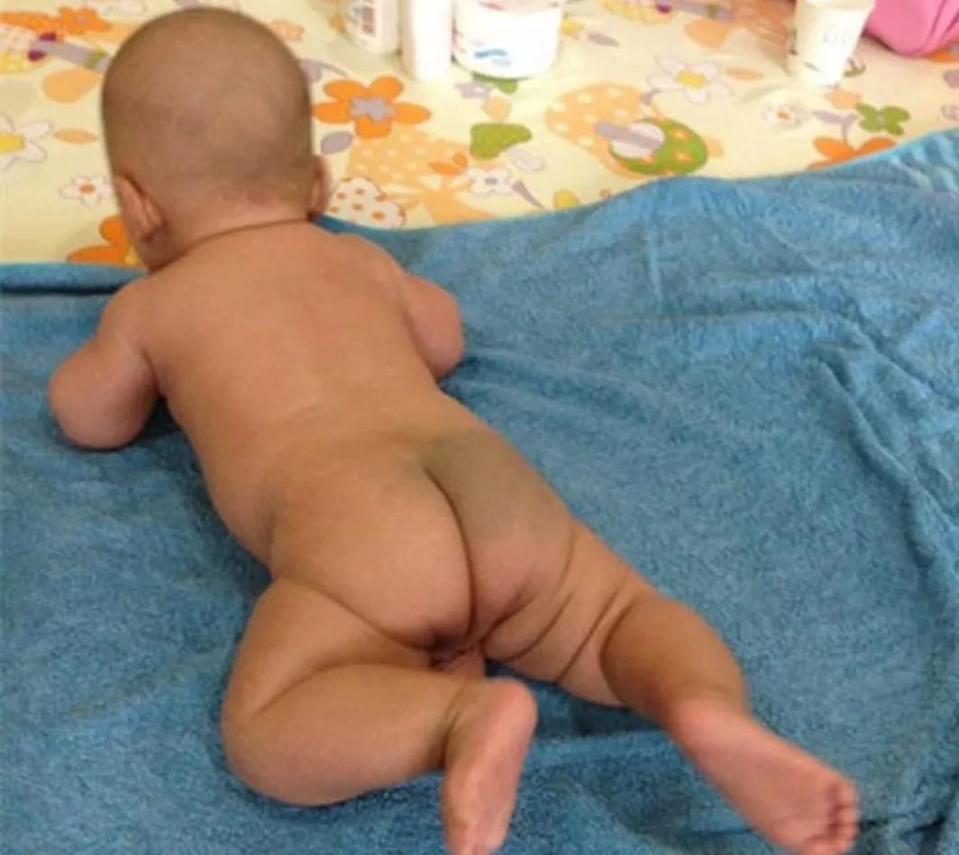 宝宝身上的胎记怎么形成的,怎么避免胎儿长胎记