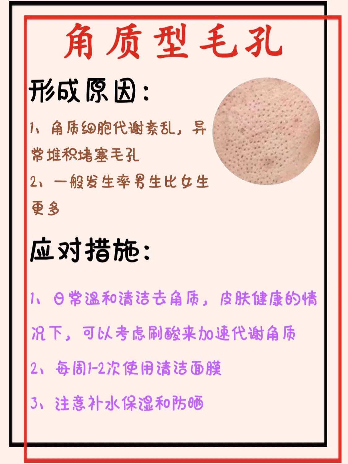 30岁女人毛孔粗大怎么办收缩毛孔,毛孔粗大收缩毛孔最有效的方法