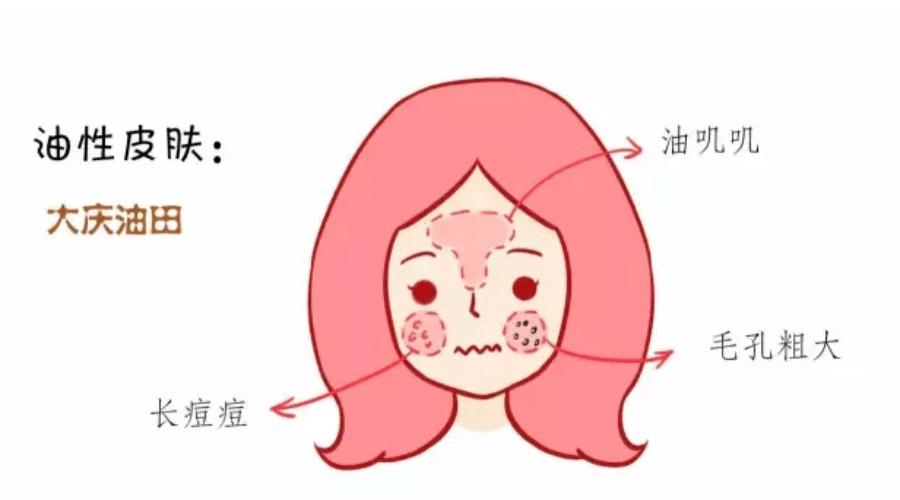 年纪越大皮肤油脂分泌越来越少,皮肤油脂分泌旺盛最好的解决方法