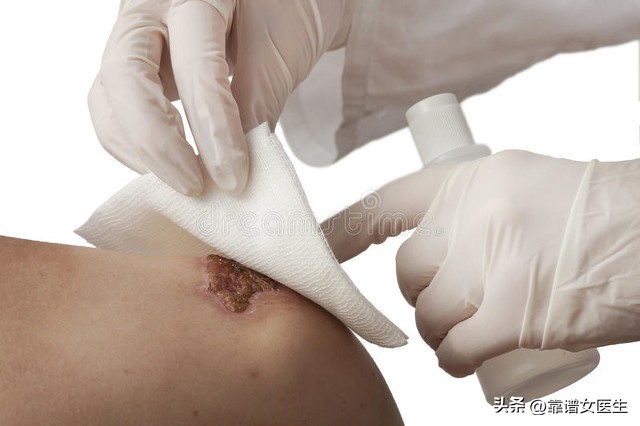 女子被狗狗咬伤面部,女子被狗狗咬伤脸后续