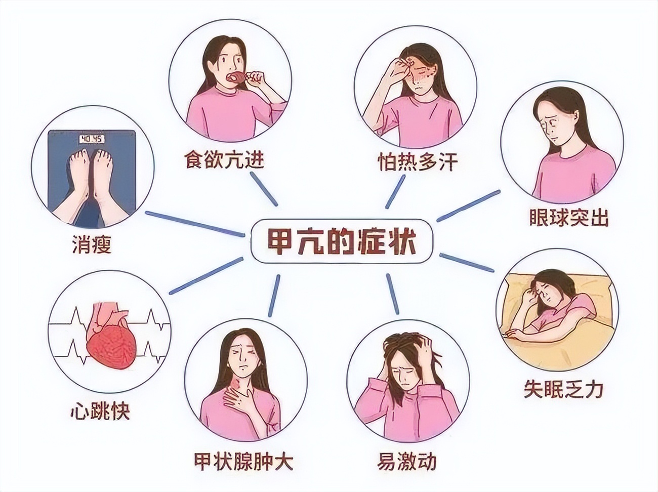 名医大讲堂甲亢的症状和危害,甲亢的症状科普