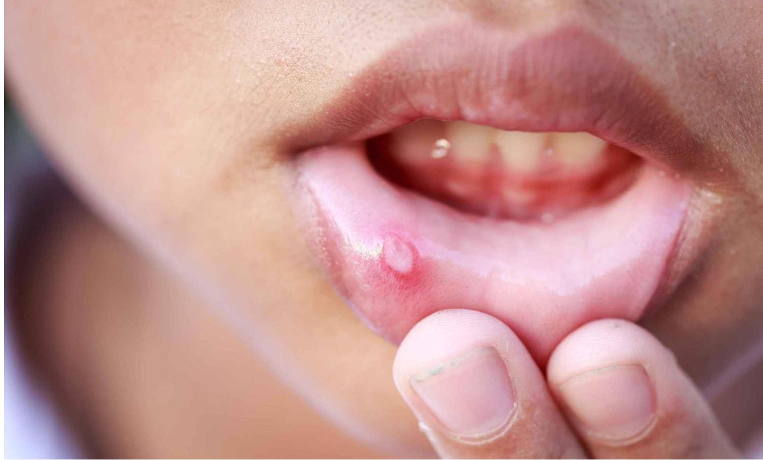 睡觉流口水要警惕四种疾病,睡觉流口水是什么病的前兆