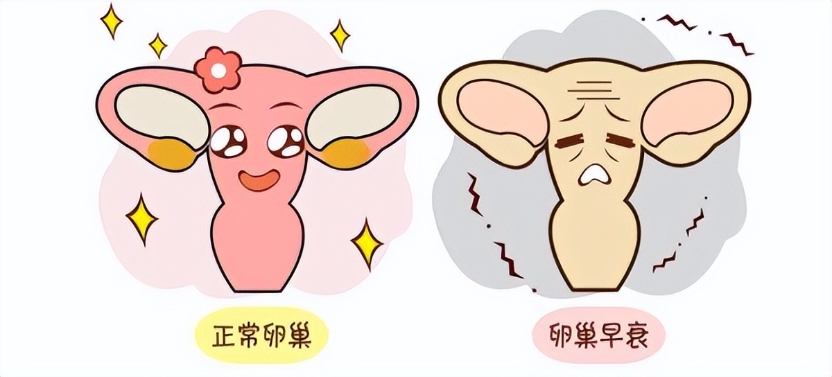 怎样判断是阴虚火旺型卵巢早衰,卵巢早衰经方四逆汤