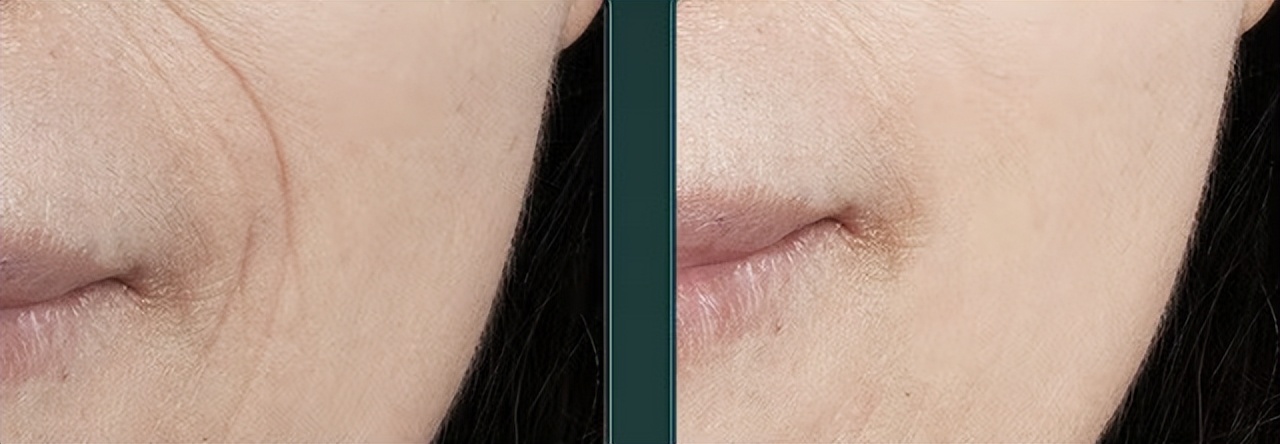 好用的面霜公认最好用排行,公认好用的面霜