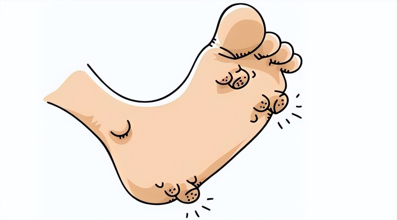 每个人身上都有疣,身上四种疣