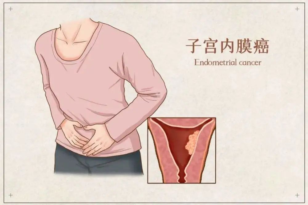 子宫癌哪些症状,子宫癌前兆有哪些不舒服