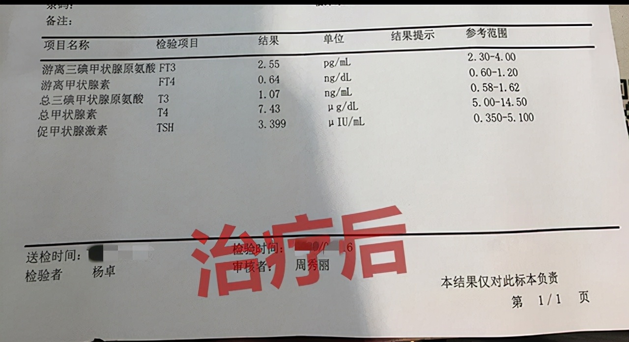 甲亢甲状腺肿大推荐什么中药,甲亢复发吃中药有效吗
