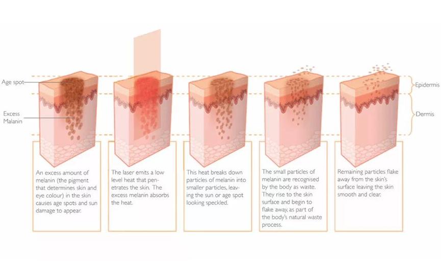 瓷娃娃美白嫩肤护理,白瓷娃娃美白嫩肤