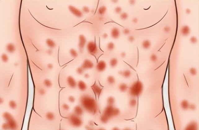 裤子都脱了，你就给我看性病？这6种疾病可要分清