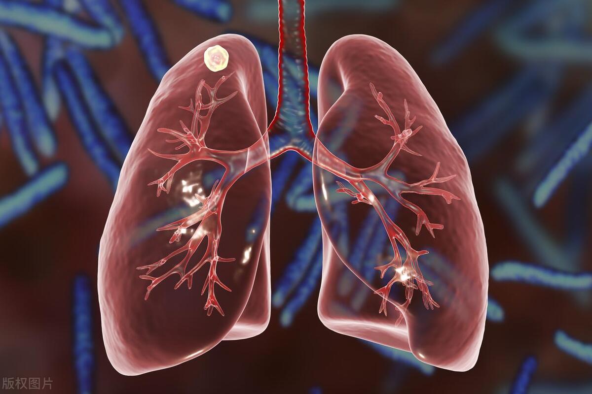 孩子支气管炎咳嗽一定要抗生素吗,咳嗽需不需要继续吃抗生素