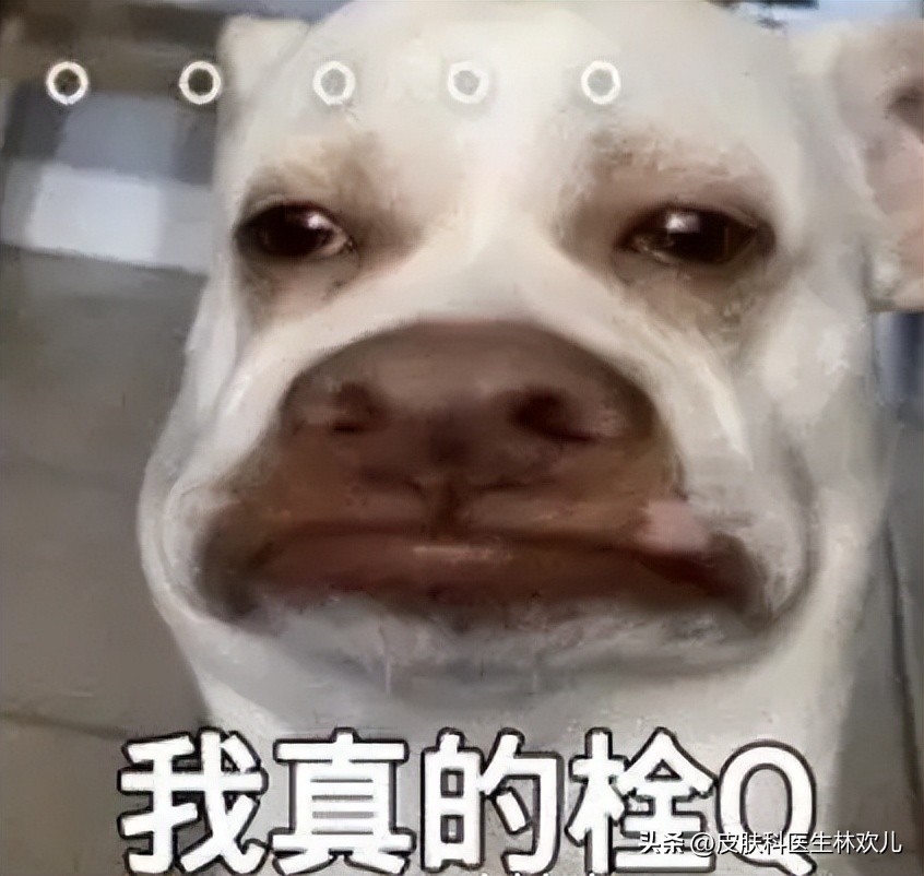 鼻翼两边泛红起皮抹芦荟胶有用吗,鼻翼两侧泛红起皮黄色结痂