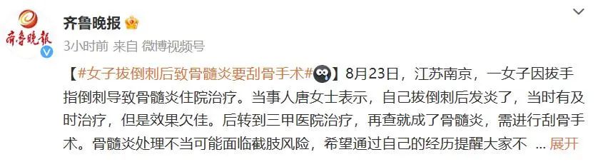 手指上长出了倒刺,要小心,不要随意乱拔,注意方式