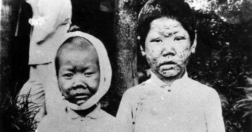 广东大虎岛麻风病医院,台山大襟岛麻风病院可以去吗