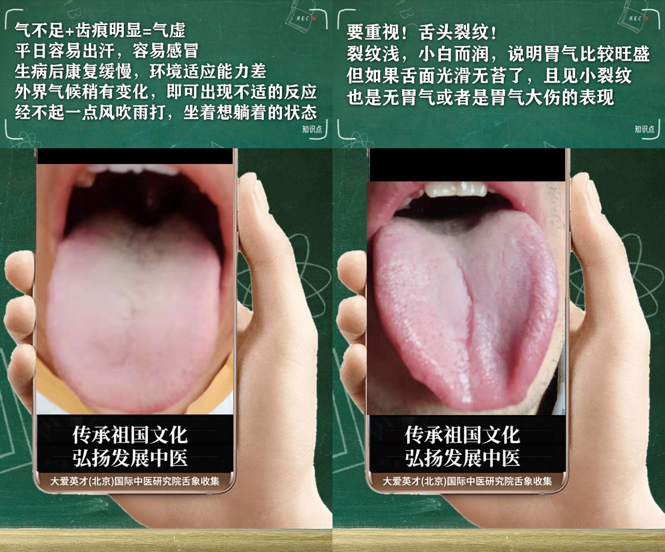 嗜睡肢冷鼻塞中医辨证,中医讲解感冒手脚冰凉