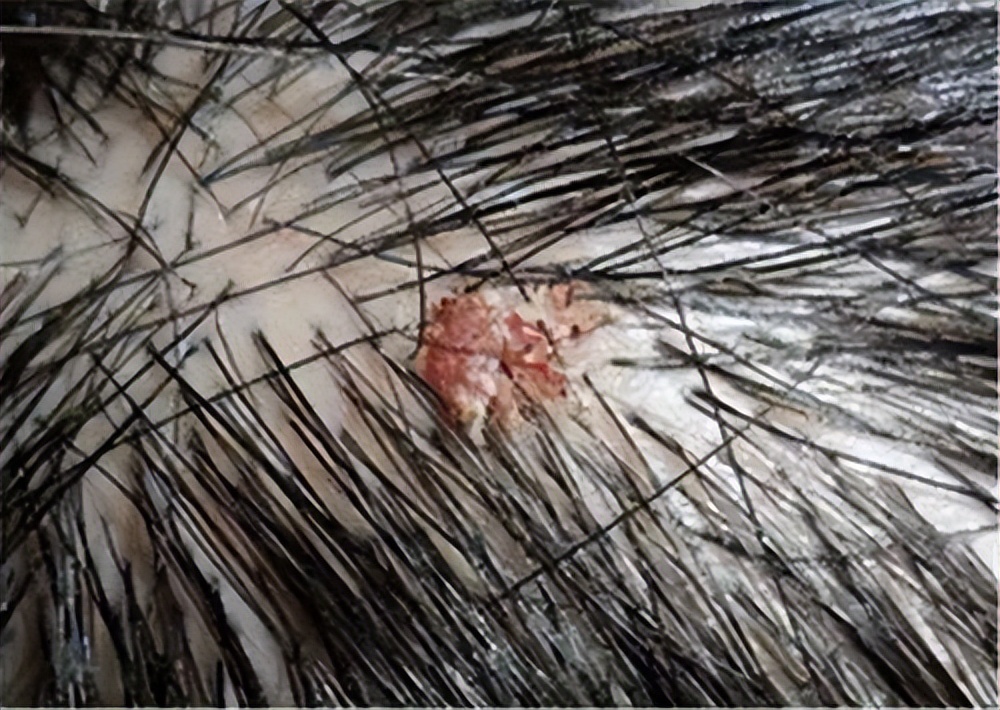 头皮经常起疙瘩有脓包是什么原因,头皮总是长疙瘩或脓包是什么原因