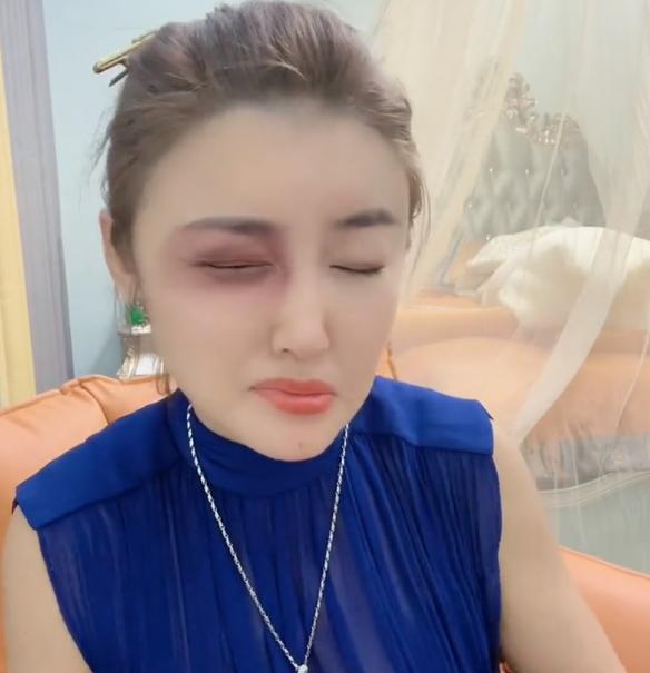 娇娇被打了吗,娇娇被打后续