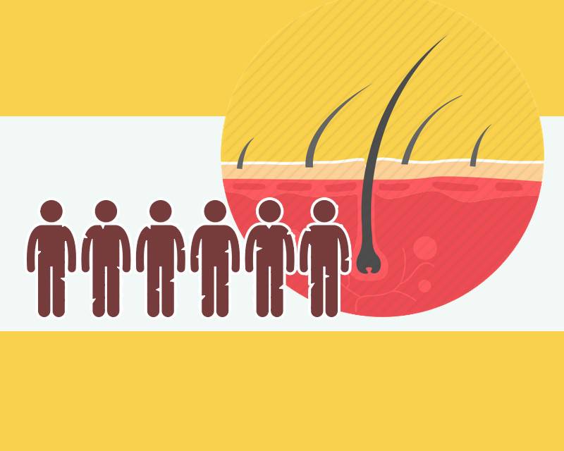 对水上乐园失去兴趣了？比起性病、阴道炎，真正要注意的这3种病