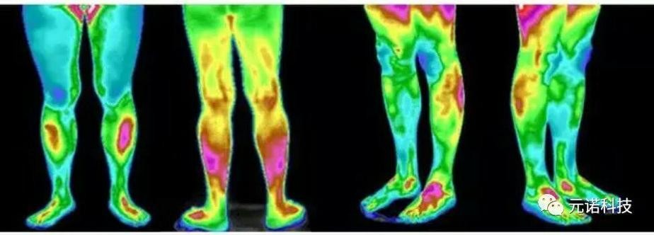 红外线热成像技术测温原理,红外热成像原理介绍