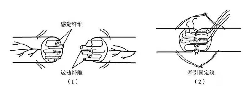 修复神经的最好方法,神经修复的最佳时间表