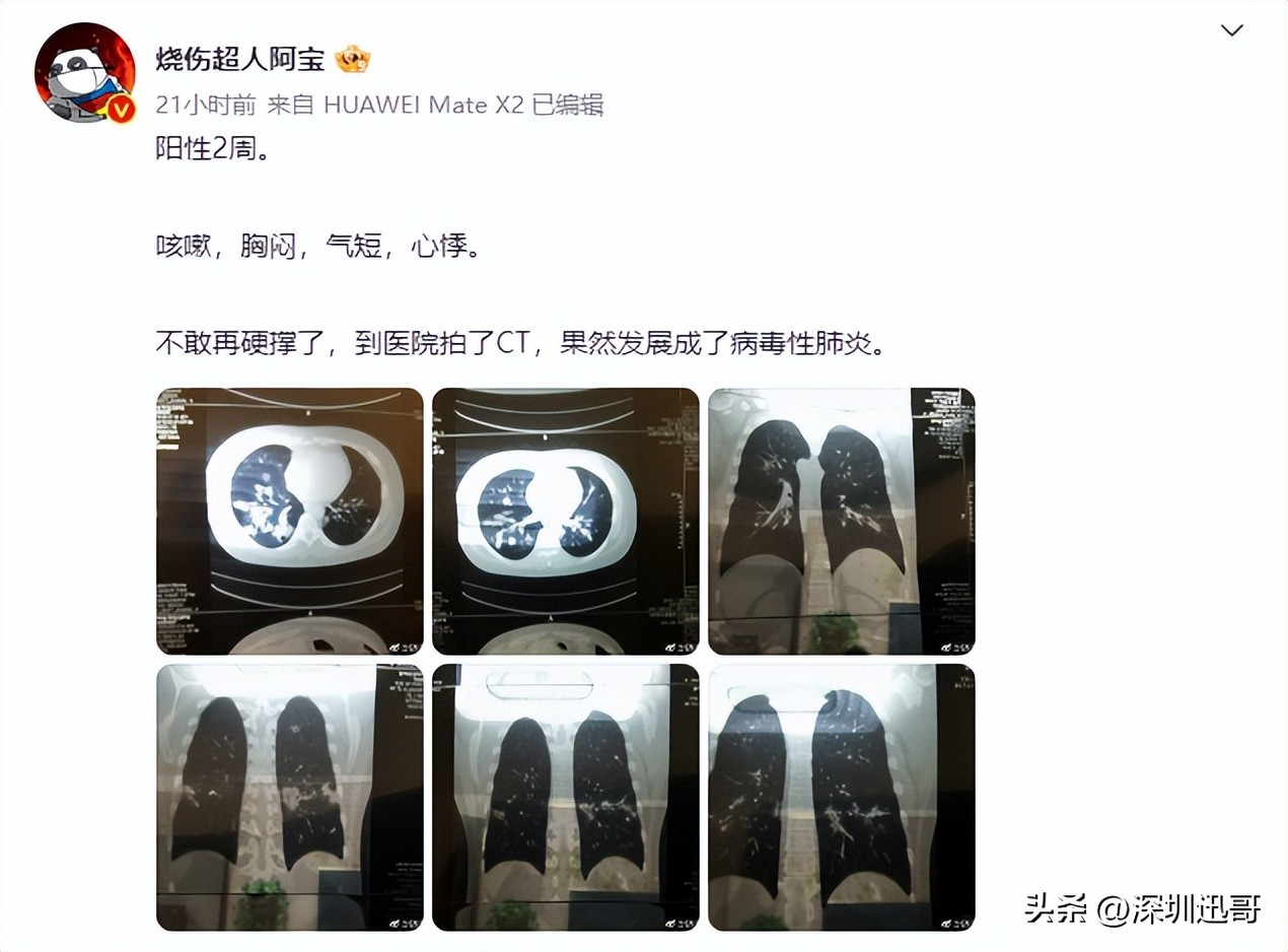 感染之后的可怕症状,肺部感染后留下后遗症